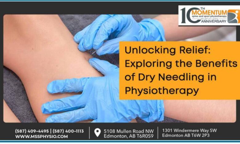 Unlocking Relief Exploring the Benefits of Dry Needling in Physiotherapy