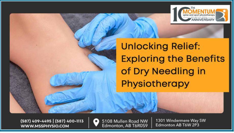 Unlocking Relief Exploring the Benefits of Dry Needling in Physiotherapy